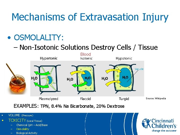 Mechanisms of Extravasation Injury • OSMOLALITY: – Non-Isotonic Solutions Destroy Cells / Tissue Blood