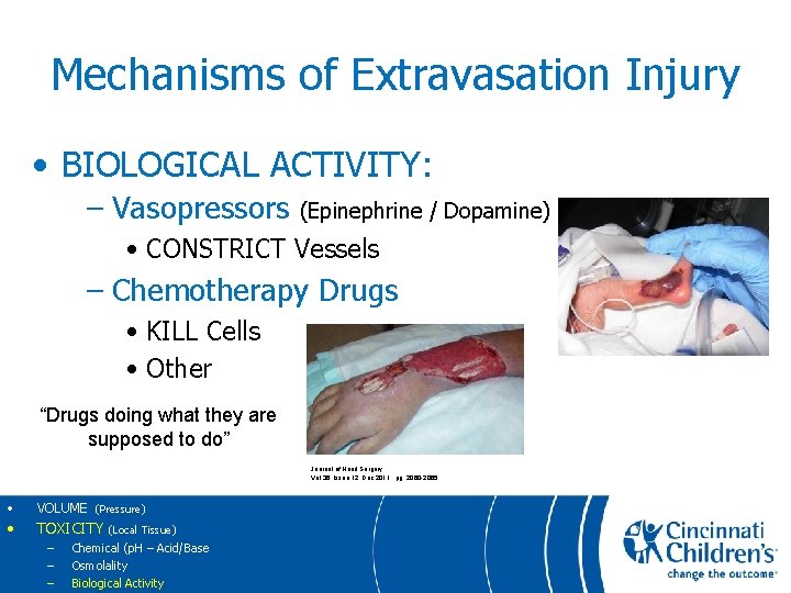 Mechanisms of Extravasation Injury • BIOLOGICAL ACTIVITY: – Vasopressors (Epinephrine / Dopamine) • CONSTRICT