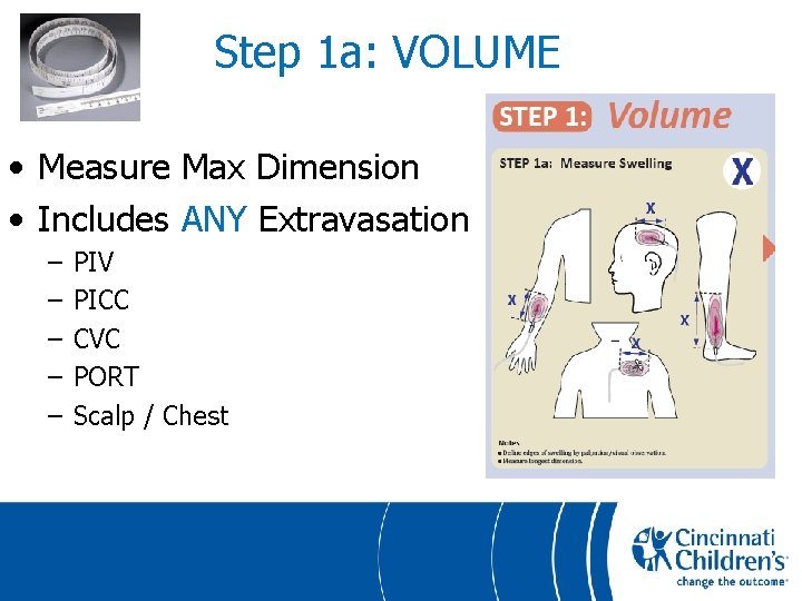 Step 1 a: VOLUME • Measure Max Dimension • Includes ANY Extravasation – –
