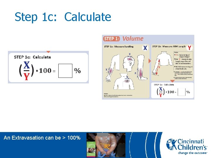 Step 1 c: Calculate An Extravasation can be > 100% 