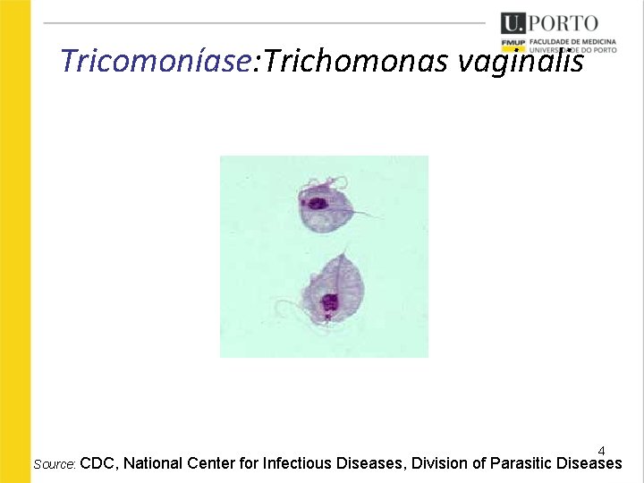 Tricomoníase: Trichomonas vaginalis Source: CDC, 4 National Center for Infectious Diseases, Division of Parasitic