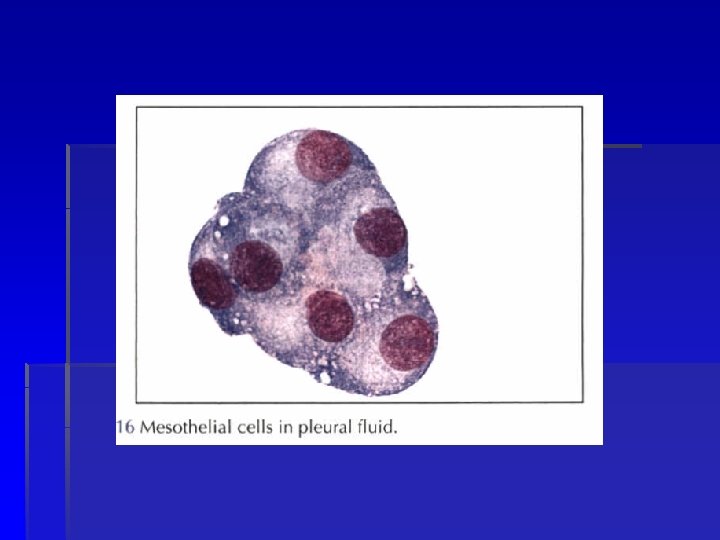 mesothelioma photodynamic therapy