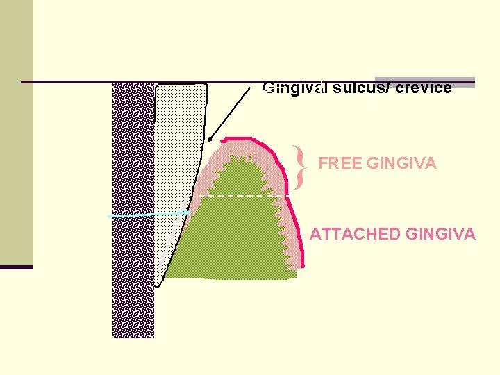 Gingival sulcus/ crevice } FREE GINGIVA ATTACHED GINGIVA 