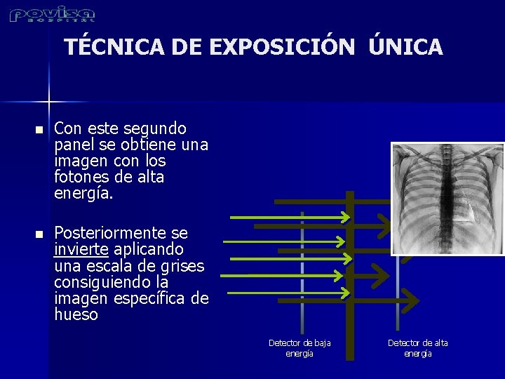 TÉCNICA DE EXPOSICIÓN ÚNICA n Con este segundo panel se obtiene una imagen con