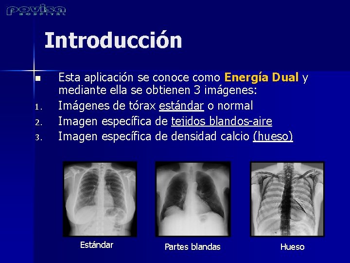 Introducción n 1. 2. 3. Esta aplicación se conoce como Energía Dual y mediante