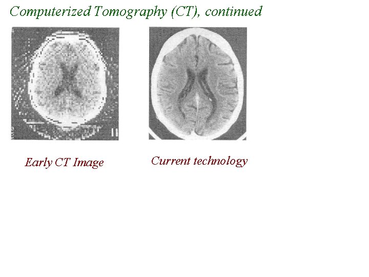 Computerized Tomography (CT), continued Early CT Image Current technology Computerized Tomography (CT), continued Early CT Image Current technology