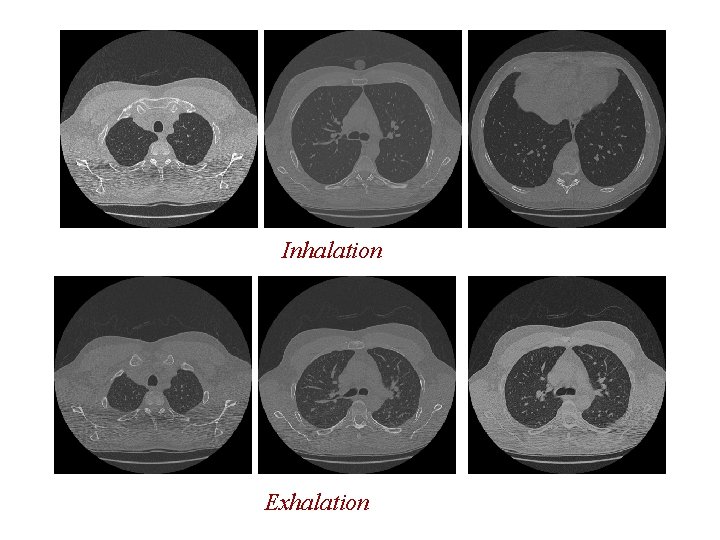 Inhalation Exhalation Inhalation Exhalation
