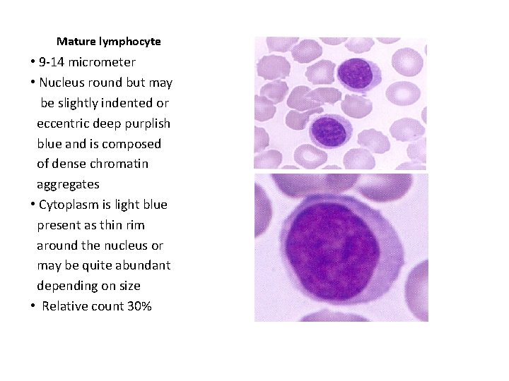 Mature lymphocyte • 9 -14 micrometer • Nucleus round but may be slightly indented
