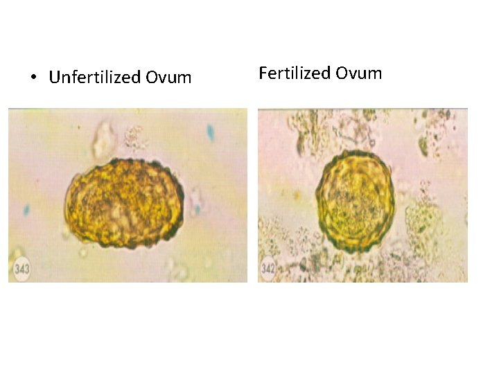 • Unfertilized Ovum Fertilized Ovum 