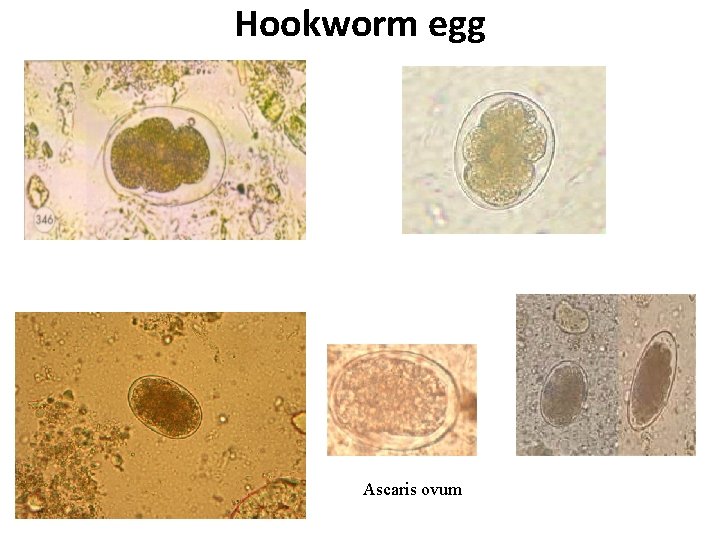 Hookworm egg Ascaris ovum 