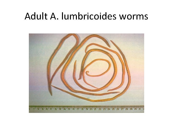 Adult A. lumbricoides worms 