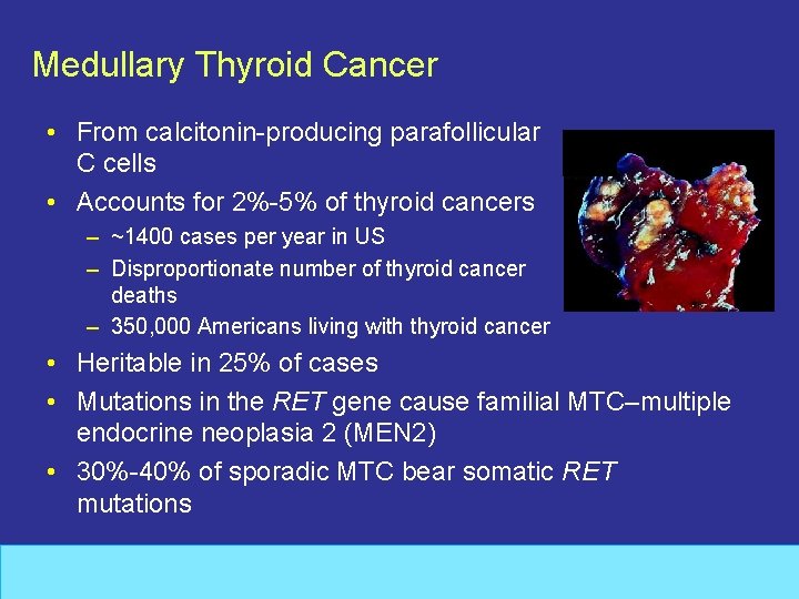 Medullary Thyroid Cancer • From calcitonin-producing parafollicular C cells • Accounts for 2%-5% of