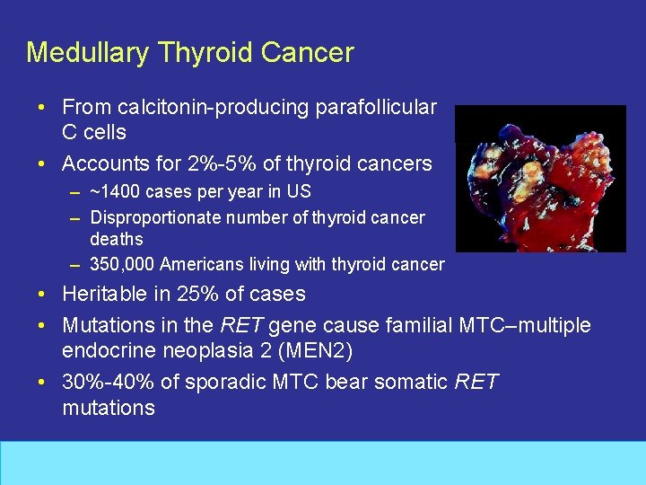 Management Advances For Differentiated And Medullary Thyroid Carcinoma