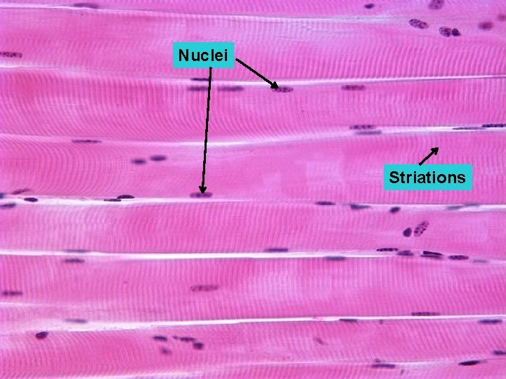 Nuclei Striations 