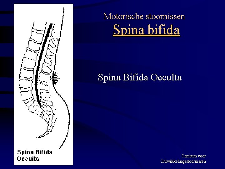 Motorische stoornissen Spina bifida Spina Bifida Occulta 08 -03 -2001 Centrum voor Ontwikkelingsstoornissen 