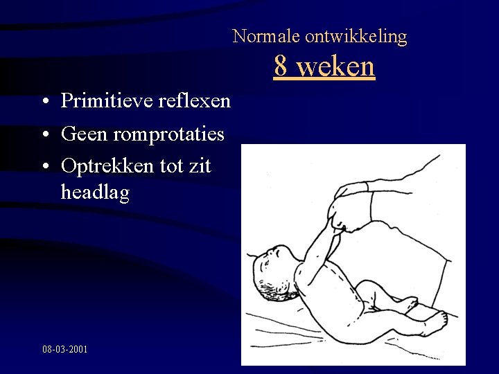 Normale ontwikkeling 8 weken • Primitieve reflexen • Geen romprotaties • Optrekken tot zit