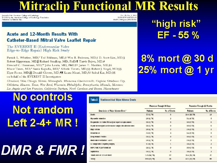 Mitraclip Functional MR Results “high risk” EF - 55 % 8% mort @ 30