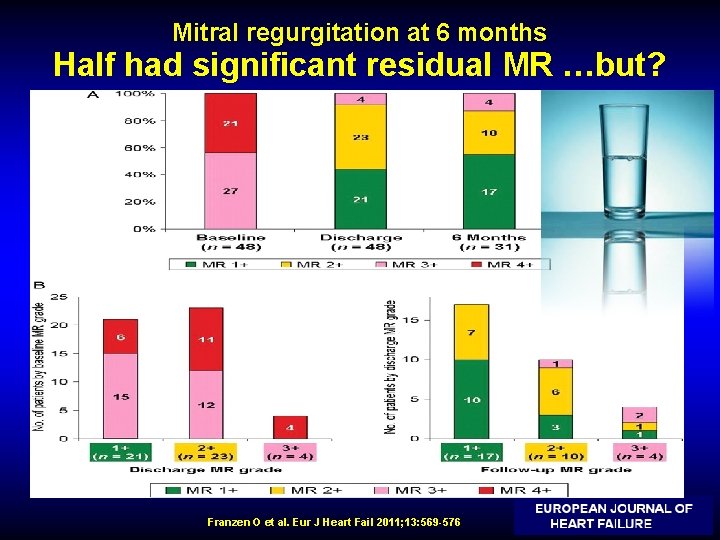 Mitral regurgitation at 6 months Half had significant residual MR …but? Franzen O et