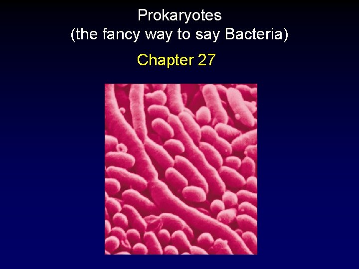 Prokaryotes (the fancy way to say Bacteria) Chapter 27 