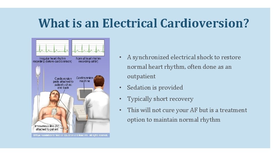 What is an Electrical Cardioversion? • A synchronized electrical shock to restore normal heart What is an Electrical Cardioversion? • A synchronized electrical shock to restore normal heart