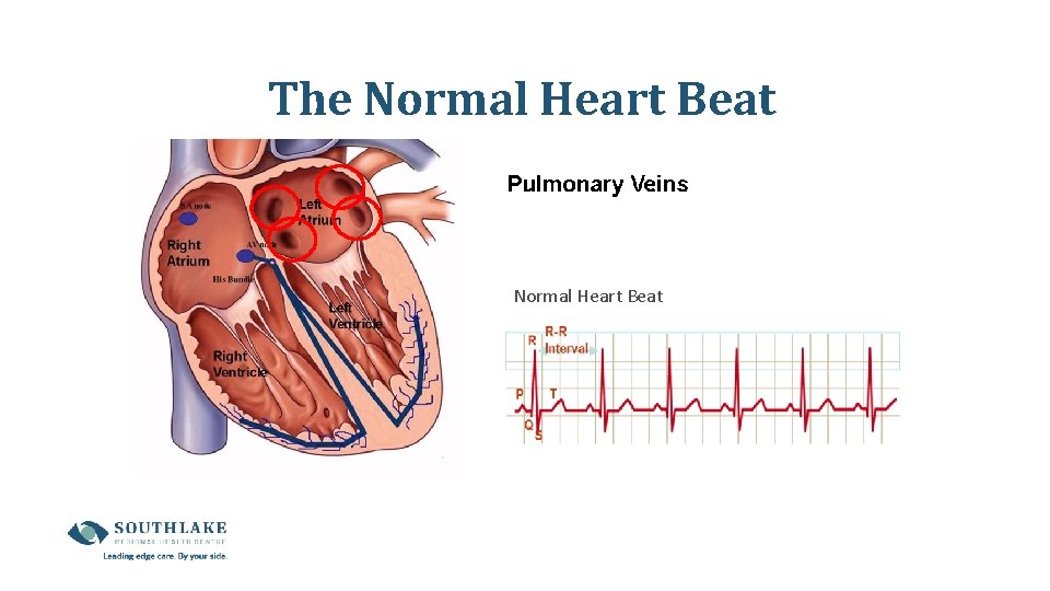 The Normal Heart Beat The Normal Heart Beat