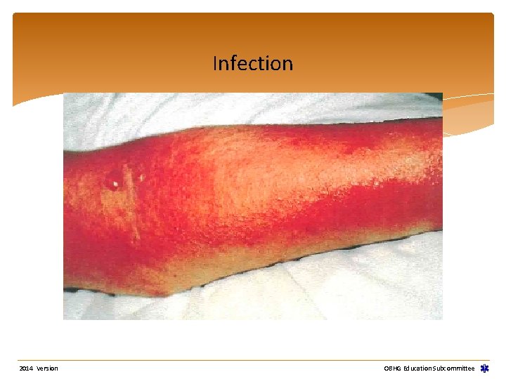 Infection 2014 Version OBHG Education Subcommittee 