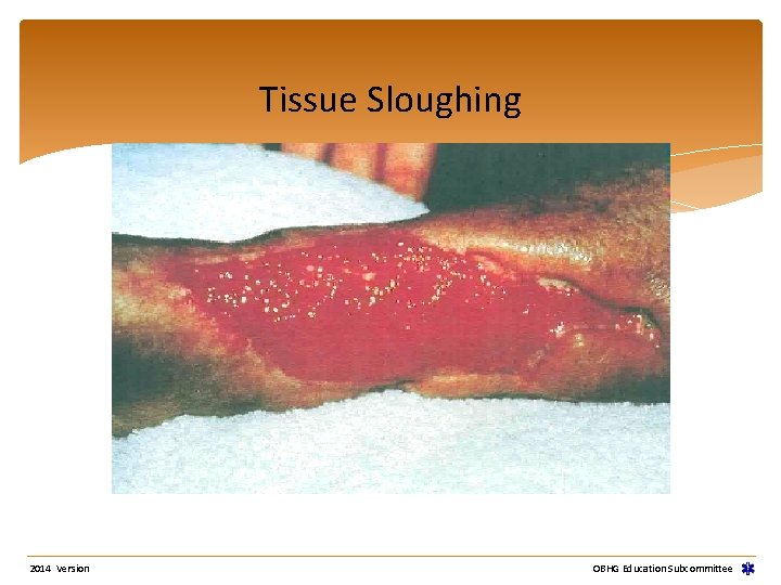 Tissue Sloughing 2014 Version OBHG Education Subcommittee 