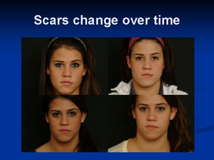 Scars change over time 