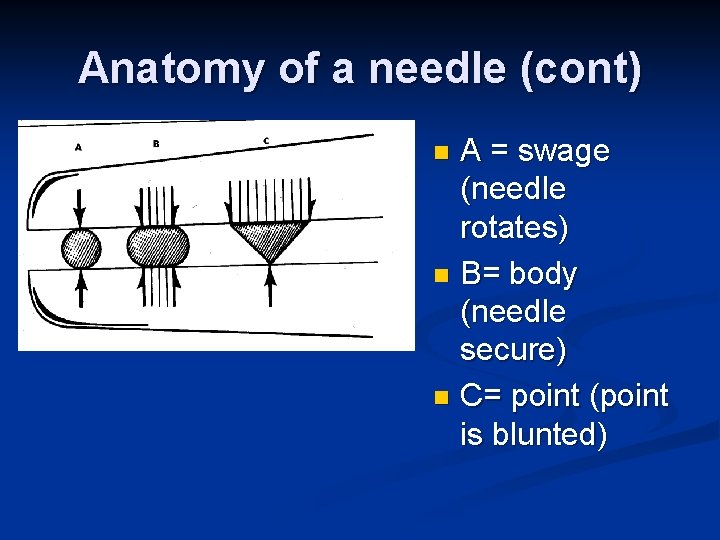 Anatomy of a needle (cont) A = swage (needle rotates) n B= body (needle