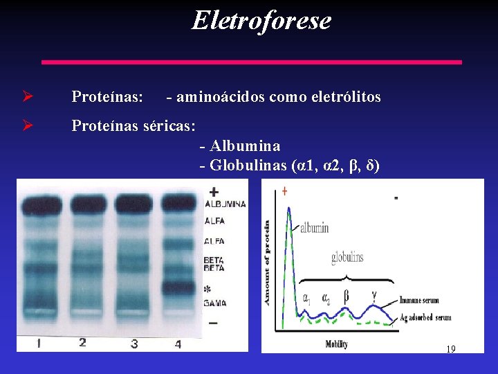 Eletroforese Ø Proteínas: Ø Proteínas séricas: - aminoácidos como eletrólitos - Albumina - Globulinas