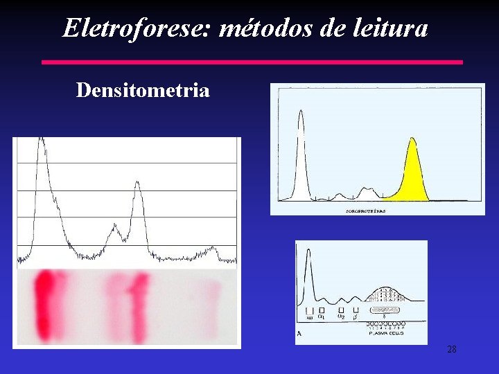Eletroforese: métodos de leitura Densitometria 28 
