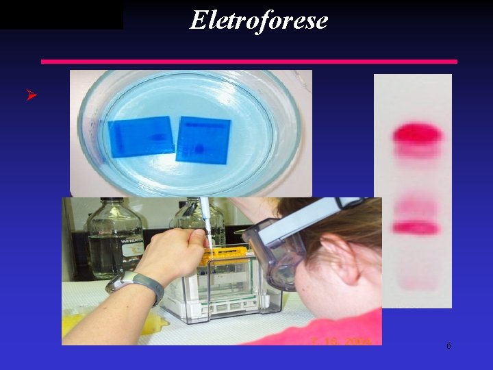 Eletroforese Ø Suportes: Meio sólido: - Papel - Acetato de celulose Meio semi-sólido: -