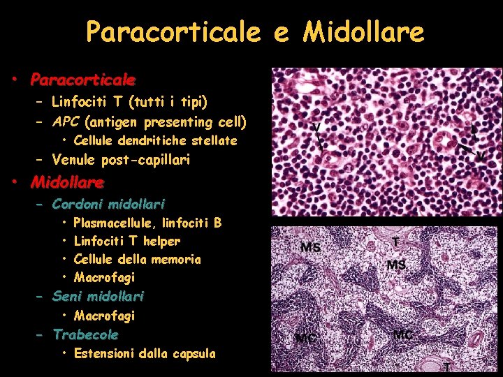 Paracorticale e Midollare • Paracorticale – Linfociti T (tutti i tipi) – APC (antigen