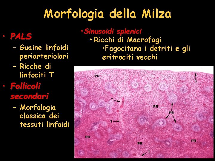 Morfologia della Milza • PALS – Guaine linfoidi periarteriolari – Ricche di linfociti T