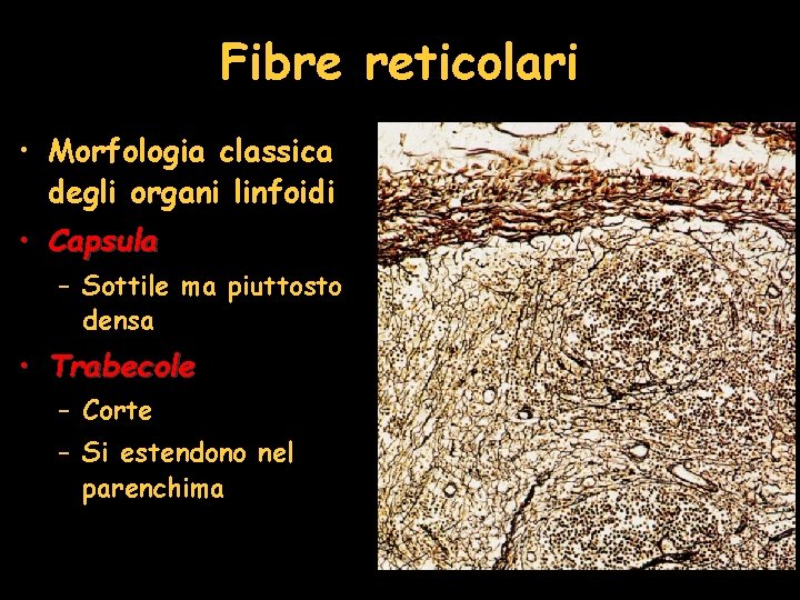 Fibre reticolari • Morfologia classica degli organi linfoidi • Capsula – Sottile ma piuttosto