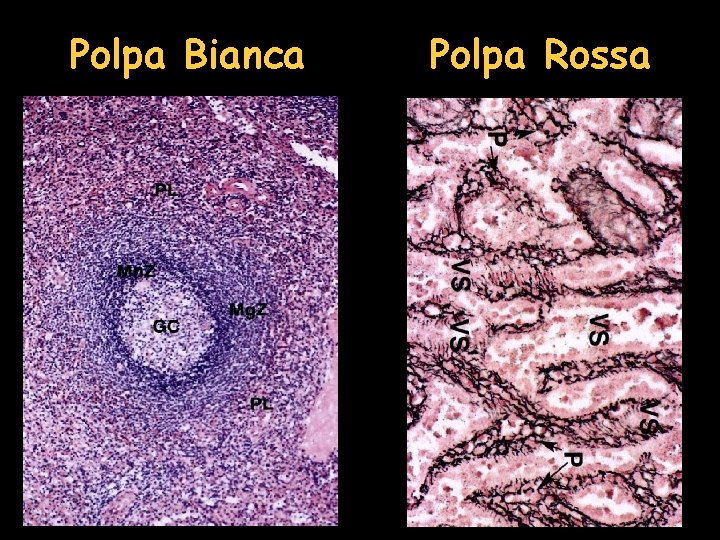 Polpa Bianca Polpa Rossa 