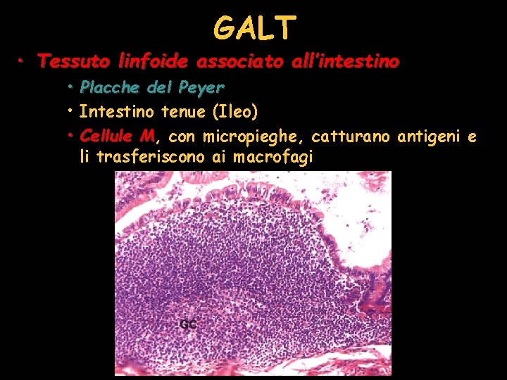 GALT • Tessuto linfoide associato all’intestino • Placche del Peyer • Intestino tenue (Ileo)