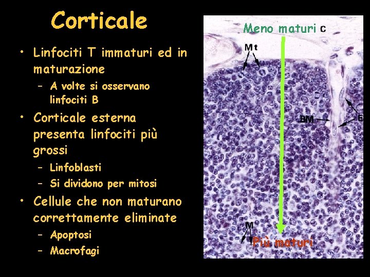 Corticale Meno maturi • Linfociti T immaturi ed in maturazione – A volte si