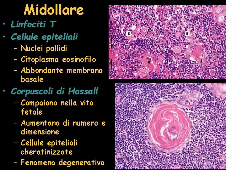 Midollare • Linfociti T • Cellule epiteliali – Nuclei pallidi – Citoplasma eosinofilo –