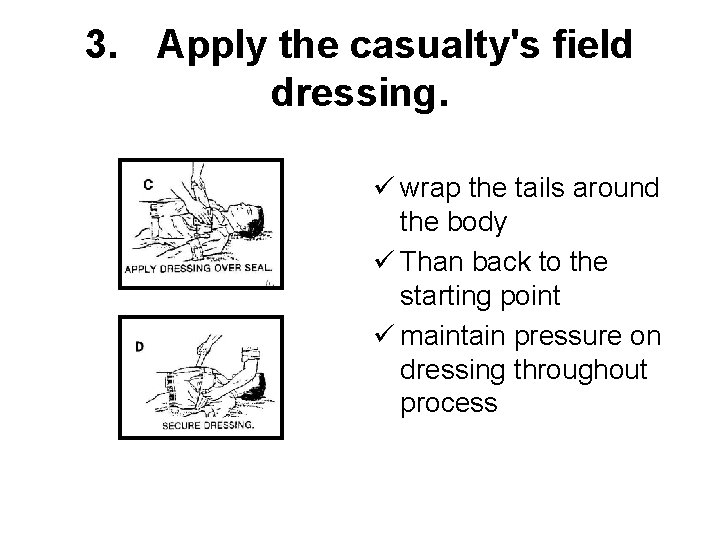 3. Apply the casualty's field dressing. ü wrap the tails around the body ü