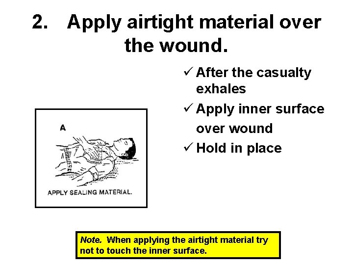 2. Apply airtight material over the wound. ü After the casualty exhales ü Apply
