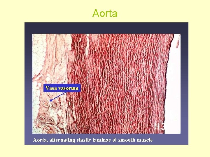 Aorta 