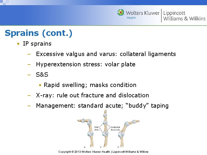 Sprains (cont. ) • IP sprains – Excessive valgus and varus: collateral ligaments –