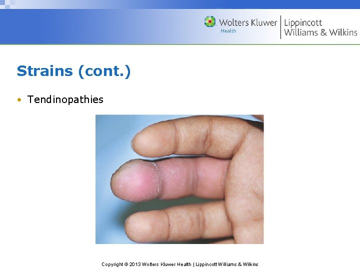 Strains (cont. ) • Tendinopathies Copyright © 2013 Wolters Kluwer Health | Lippincott Williams