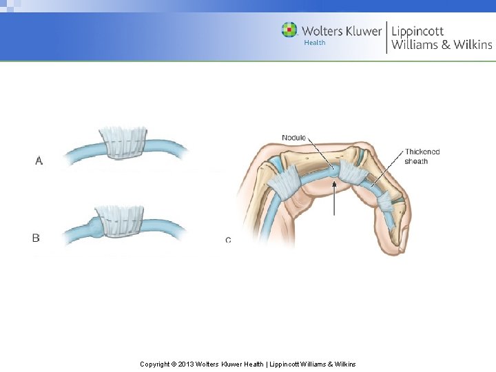 Copyright © 2013 Wolters Kluwer Health | Lippincott Williams & Wilkins 