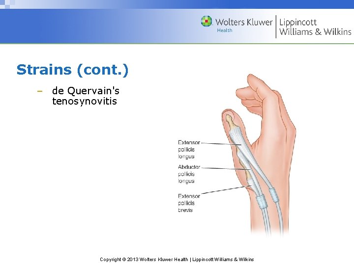 Strains (cont. ) – de Quervain's tenosynovitis Copyright © 2013 Wolters Kluwer Health |