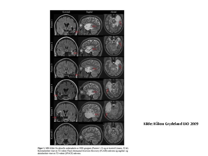 Kilde: Håkon Grydeland Ui. O 2009 