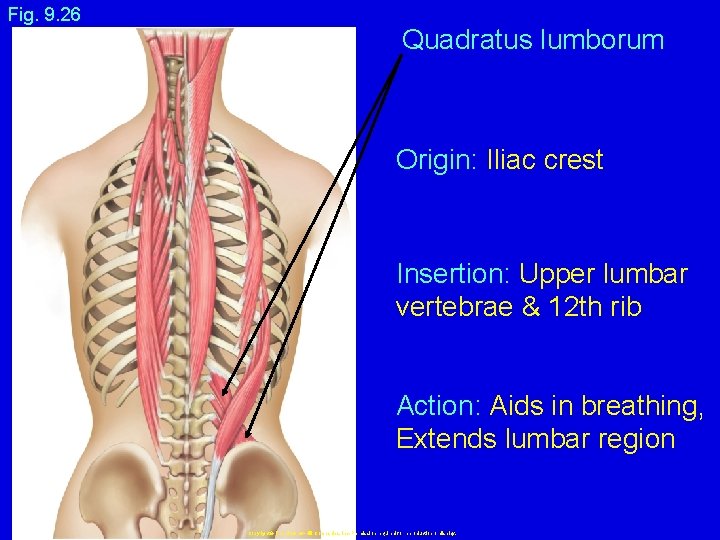 Fig. 9. 26 Quadratus lumborum Origin: Iliac crest Insertion: Upper lumbar vertebrae & 12