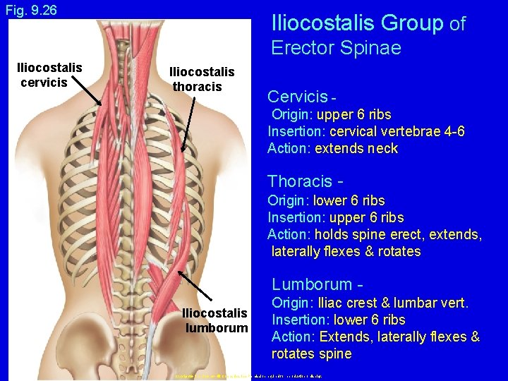 Fig. 9. 26 Iliocostalis Group of Erector Spinae Iliocostalis cervicis Iliocostalis thoracis Cervicis Origin: