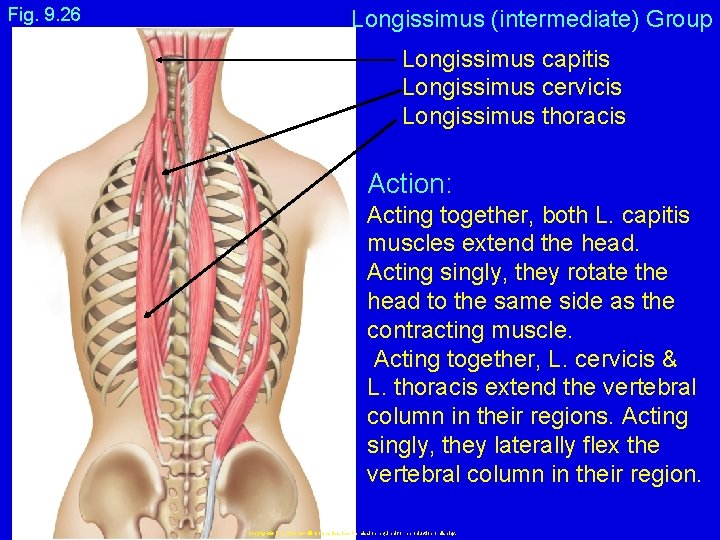 Fig. 9. 26 Longissimus (intermediate) Group Longissimus capitis Longissimus cervicis Longissimus thoracis Action: Acting